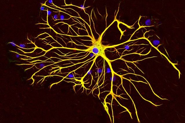 Astrocyte5